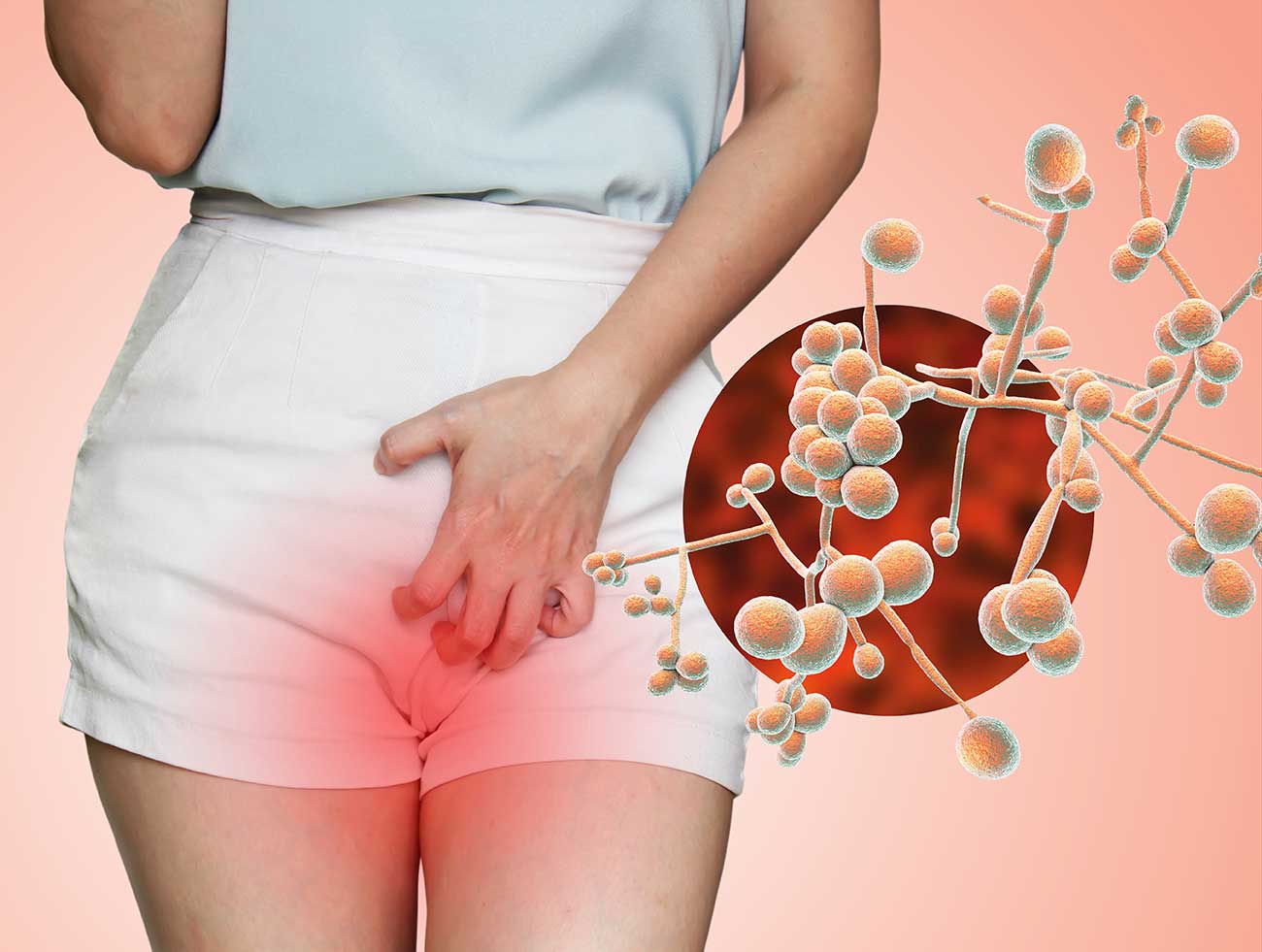 7 Best Homeopathic Remedies For Vaginal Candidiasis